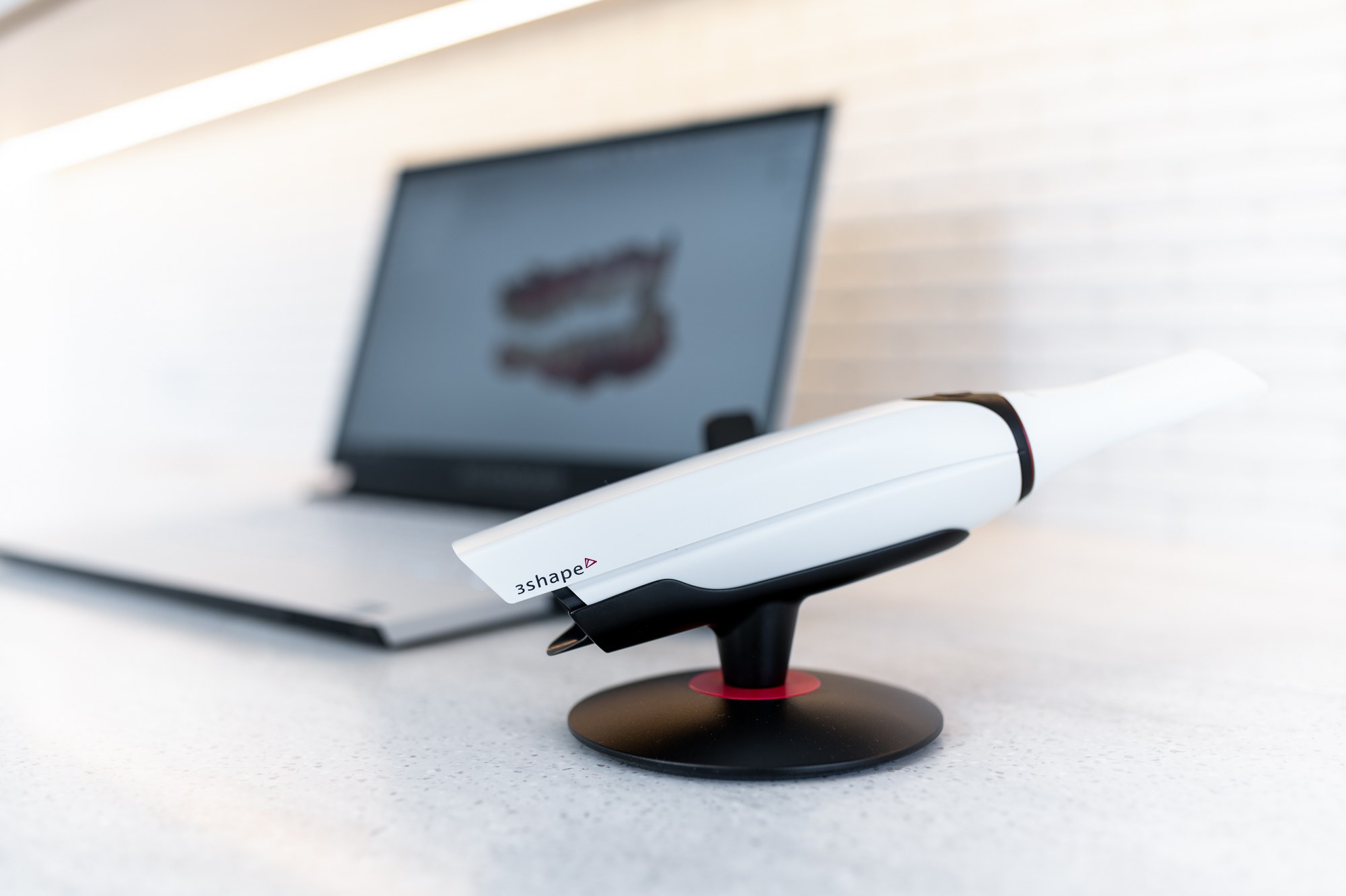 Dental scanning equipment beside a laptop showing a digital model